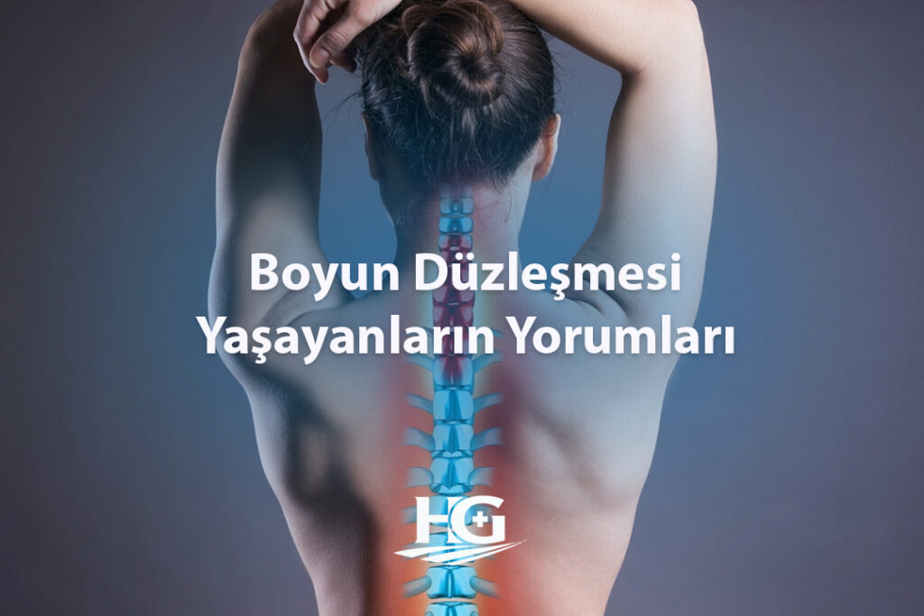 Boyun Düzleşmesi Yaşayanların Yorumları