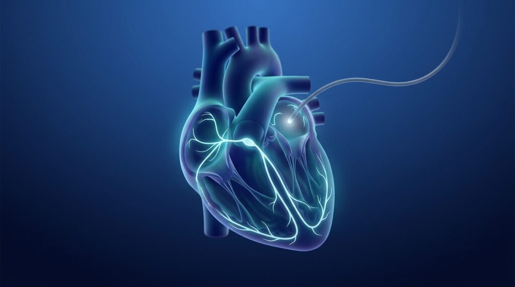Ablasyon Tedavisi Nedir ve Yaptıranların Yorumları